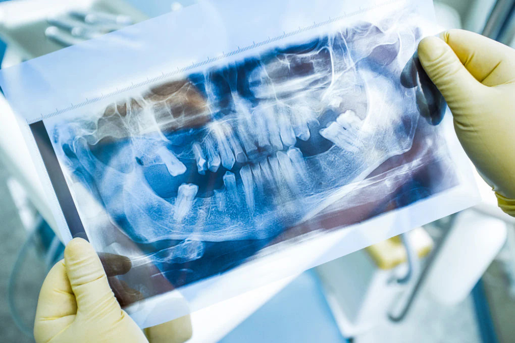 A do të kemi në të ardhmen një ilaç që rrit dhëmbët?