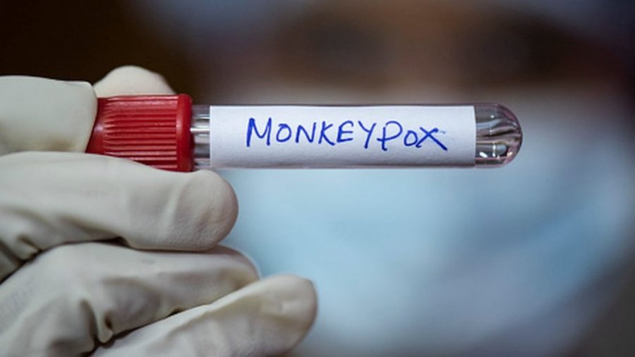 OBSH shpalli fundin e epidemisë së lijës së majmunit
