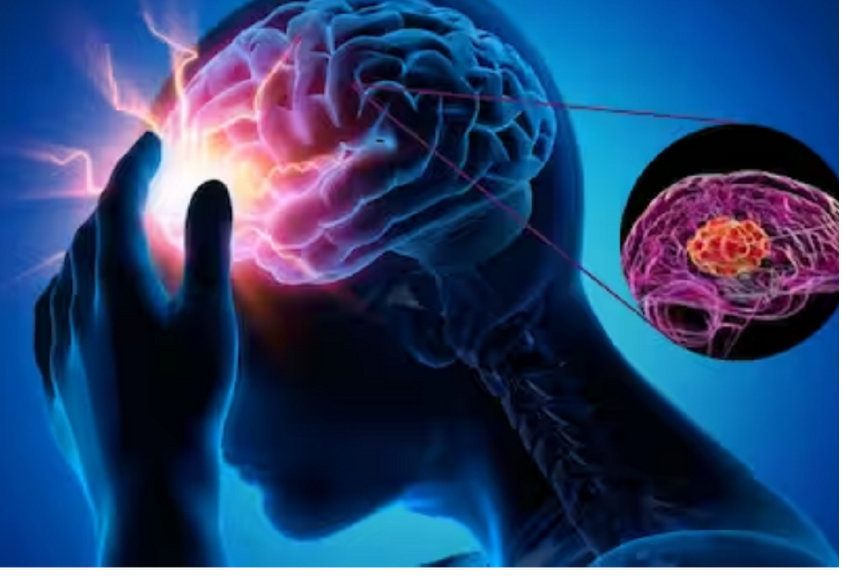A mund të çojë migrena kronike në dëmtim afatgjatë të trurit?