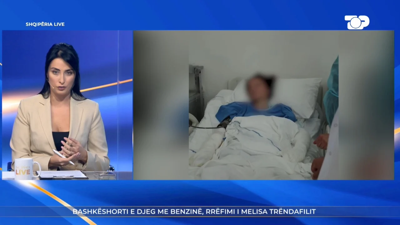 “Nuk fle dot, trembem”/ U dogj me benzinë nga ish-bashkëshorti, flet për “Shqipëria Live” Melisa: Më del imazhi i tij para syve, dëme në 80% të trupit