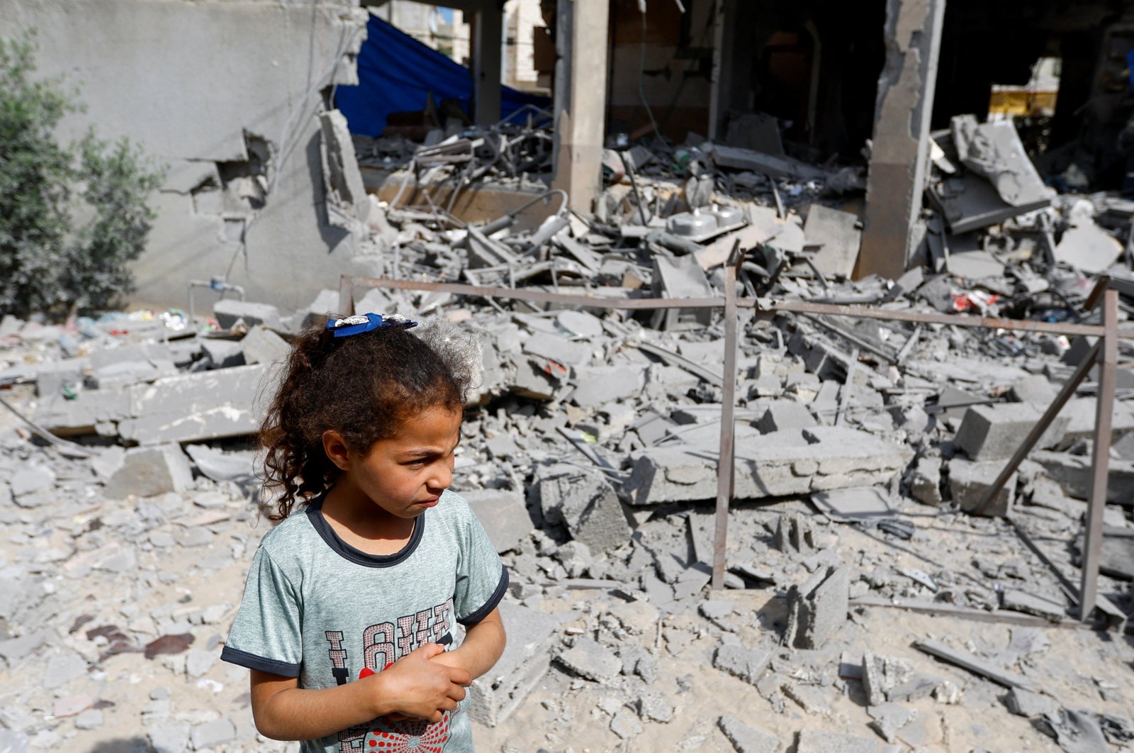 UNICEF: Fëmijët në Rripin e Gazës përballen me kequshqyerjen dhe sëmundjet