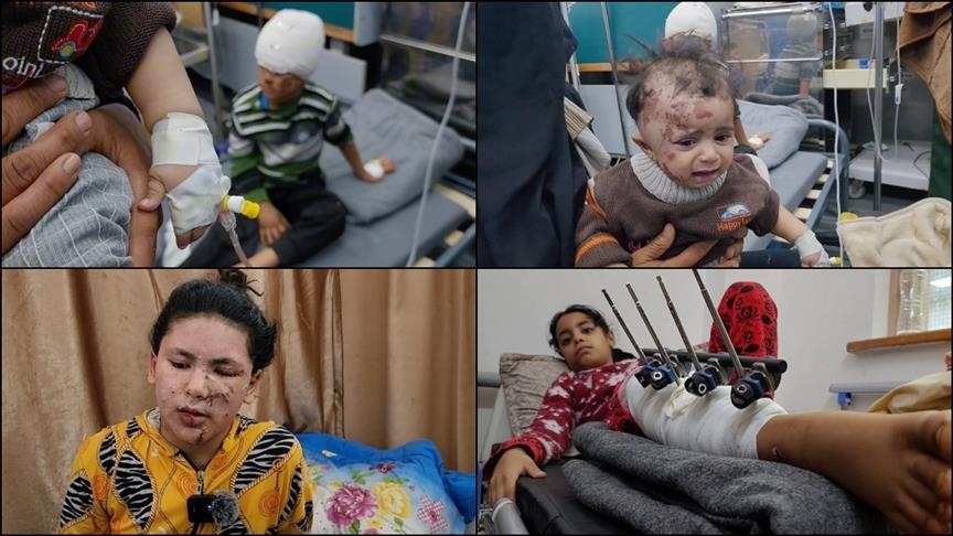 Fëmijët e plagosur nga sulmet izraelite në Gaza rrëfejnë tmerrin e përjetuar