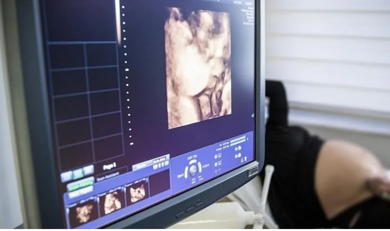  SHBA- Kryhet operacion i trurit në një foshnjë në barkun e nënës