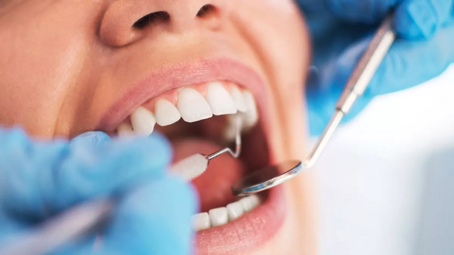 Dentistja britanike paralajmëron se ‘pija e njohur’ shkakton ‘frymë të keqe’ dhe kavitete në dhëmbë