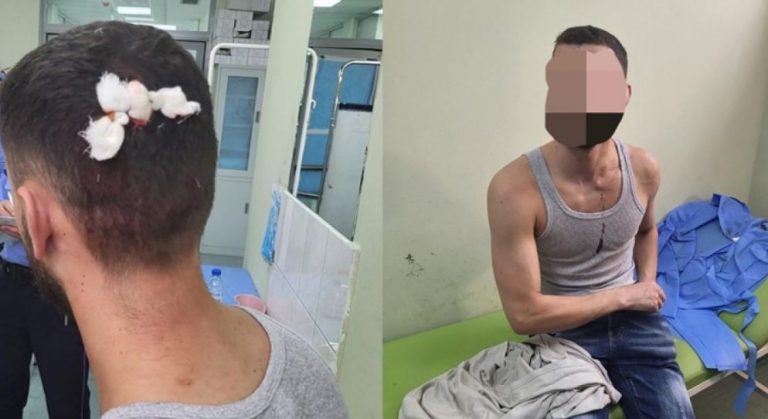 Dy shqiptarë u goditën në veri të Mitrovicës, reagon policia e Kosovës: U sulmuan nga grupe kriminale