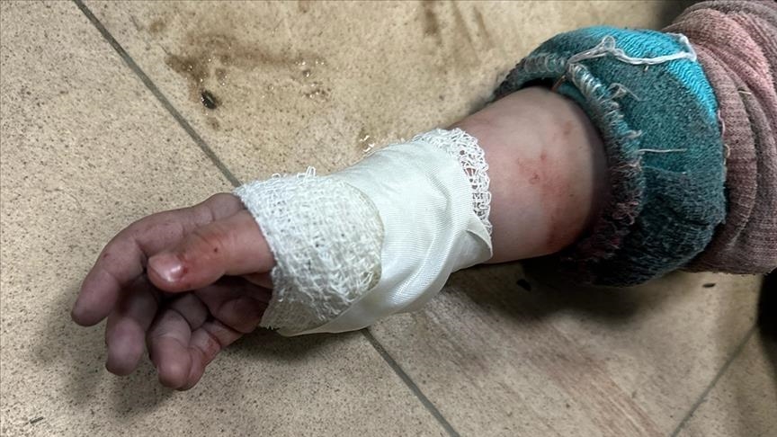 Kolumbia do të ofrojë trajtim për 50 fëmijë të Gazës të plagosur në sulmet izraelite