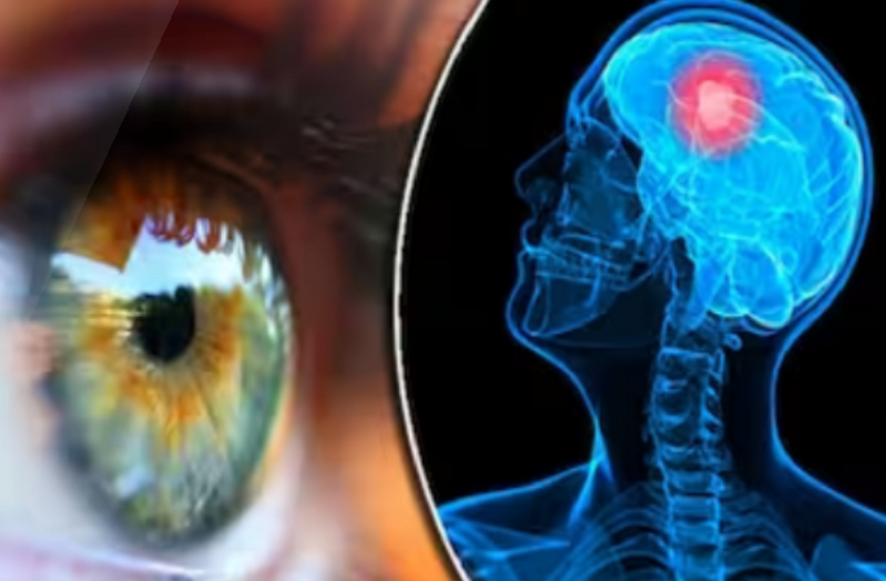 Simptomat e tumorit të trurit: 10 shenja të pazakonta që mund të shfaqen në sy dhe në fytyrë