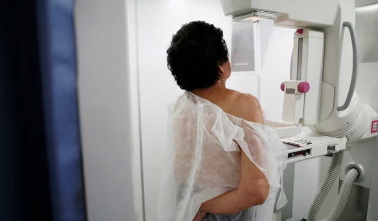 Studimi suedez: Inteligjenca Artificiale ndihmon në diktimin e kancerit të gjirit