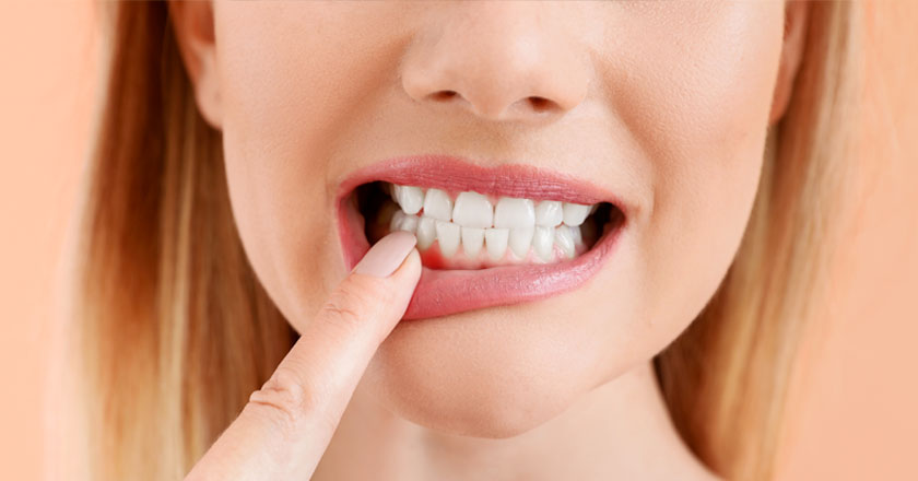 Nivelet e larta të stresit mund të lexohen edhe te mishrat e dhëmbëve