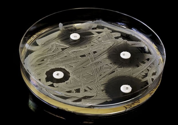 IA zbulon bakterin më rezistent dhe më të rrezikshëm në botë