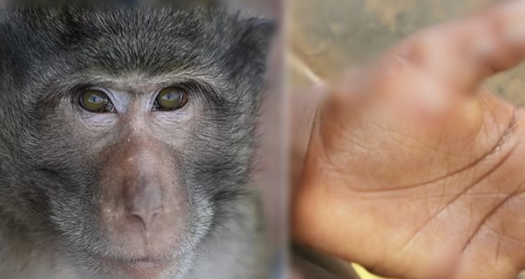 Pakistani konfirmon rastin e parë, lija e majmunit prek 25-vjeçarin
