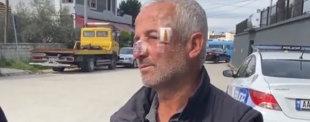 U dhunua nga shefi për formularin e PS, Berisha: Rasti, dëshmi tronditëse