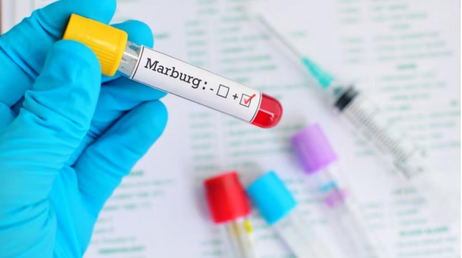 Çfarë është virusi Marburg që po kërcënon Afrikën Perëndimore?
