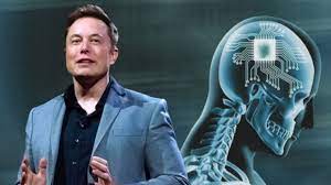 Implantohet çipi i parë në trurin e njeriut, e realizoi Neuralink e Elon Musk