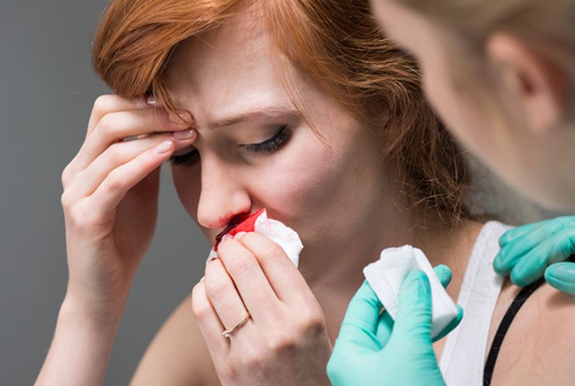 Përse duhet të shqetësoheni nëse ju rrjedh gjak nga hunda