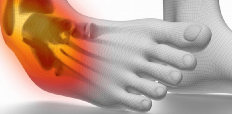 Ndrydhja e kyçit të këmbës: Si të trajtoni këtë dëmtim muskuloskeletor në shtëpi