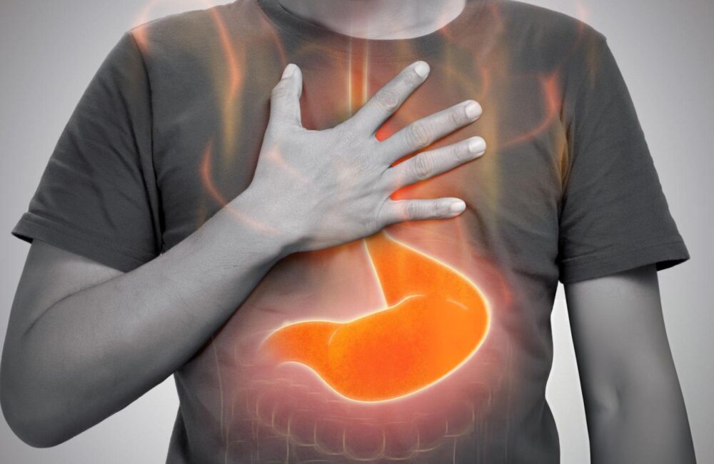 Refluksi Gastroezofageal – Çfarë duhet të dini për djegien e stomakut